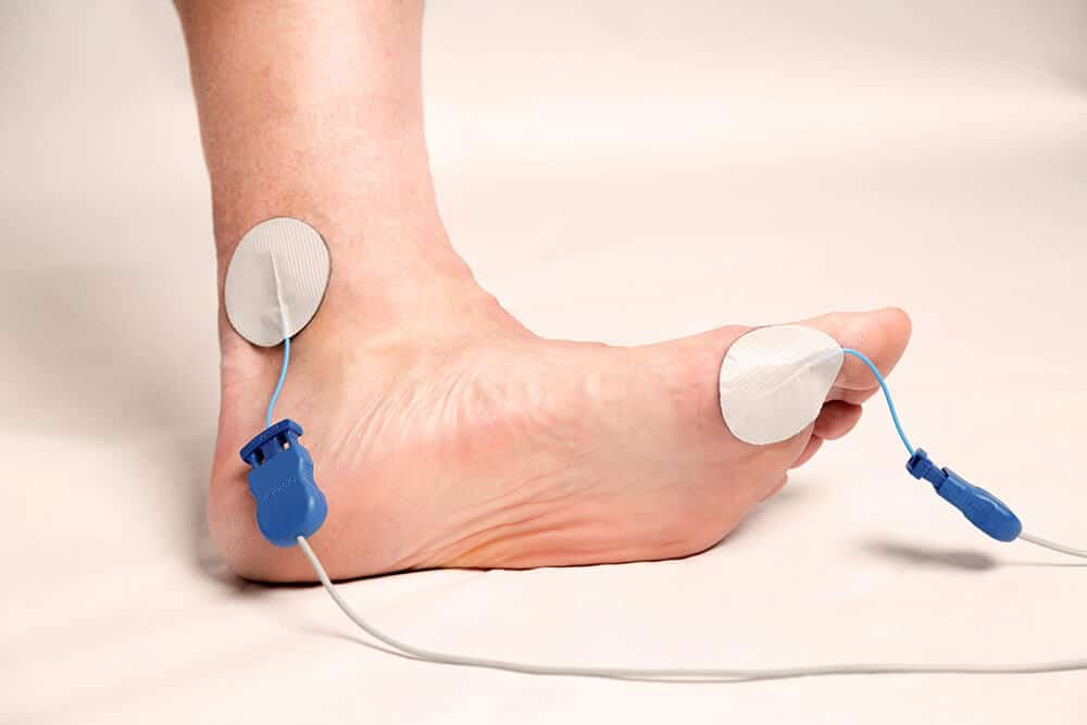 Alleviate Pain from Diabetic Peripheral Neuropathy using a TENS