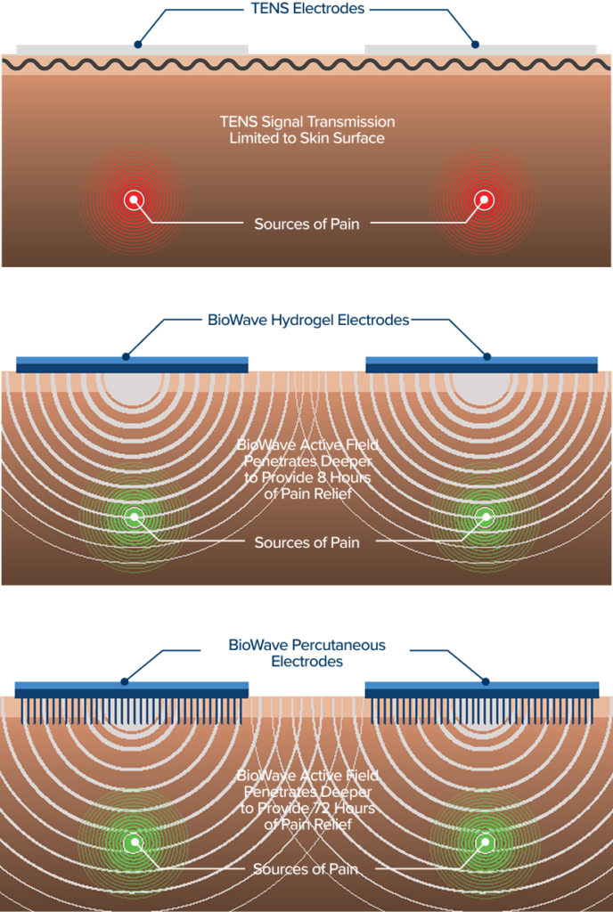 TENS vs BioWave diagram
