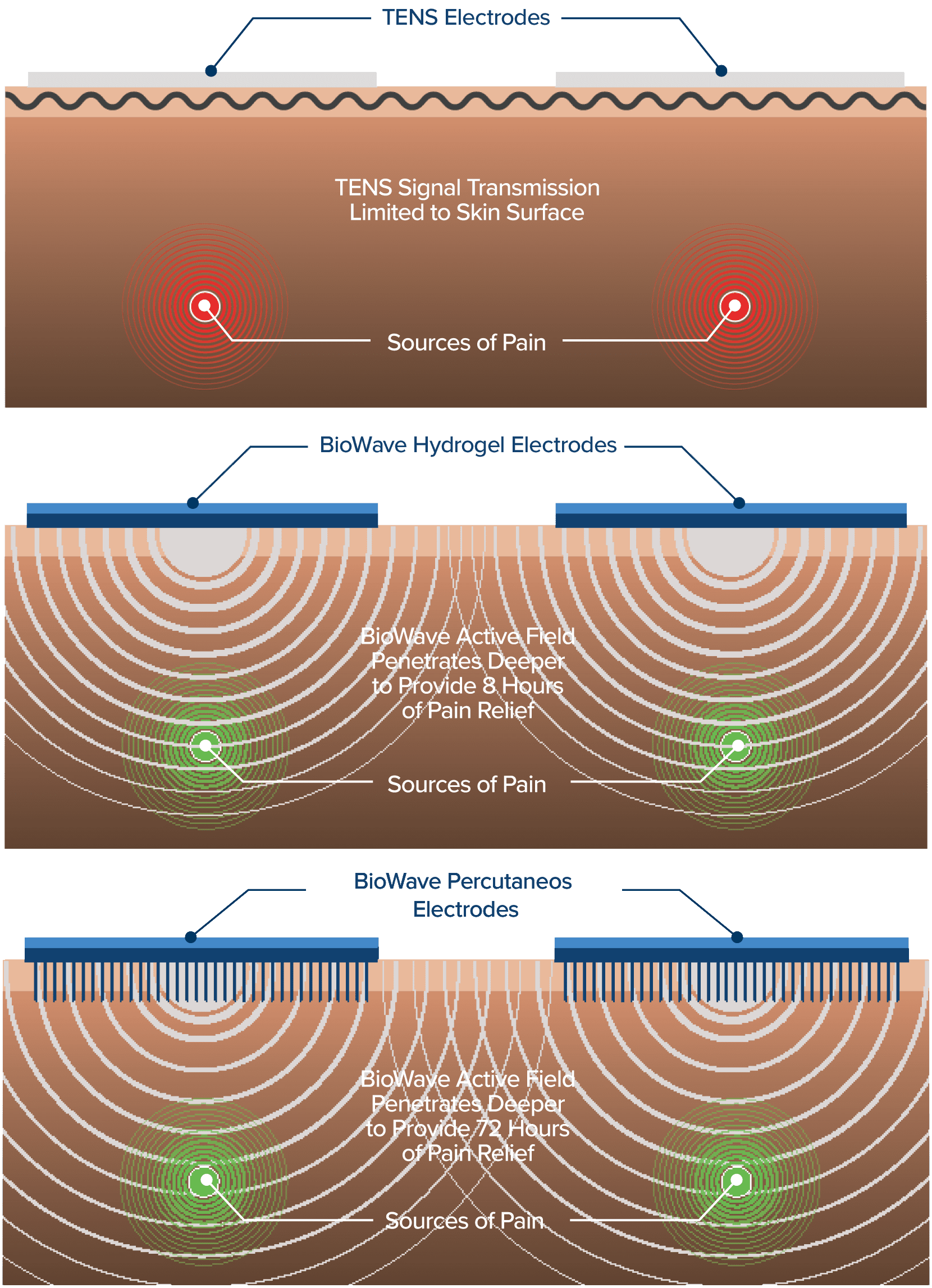 Compare BioWave Pain Relief Devices and Accessories